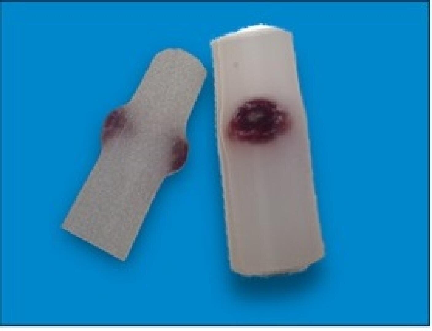 Two synthetic finger models with simulated wounds or bruises on a blue background; one model shows a superficial injury, the other a deeper, circular lesion.