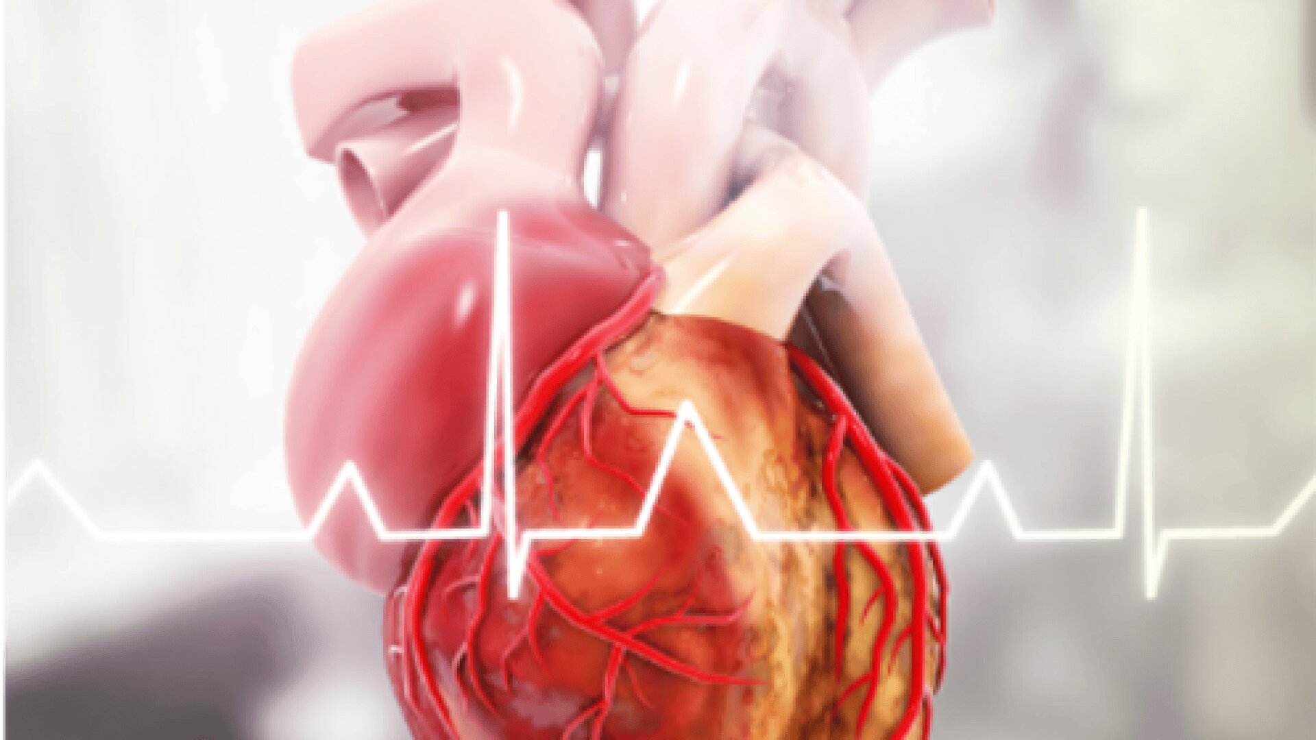 A detailed illustration of a human heart with visible arteries and veins, overlaid with an electrocardiogram (ECG) heartbeat line, set against a softly blurred, light-colored background.