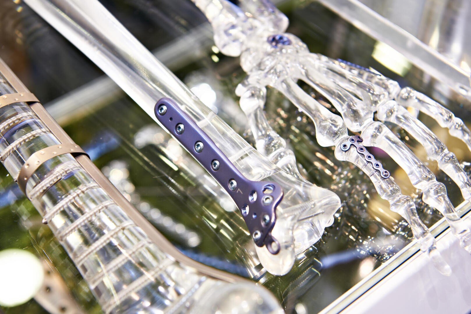 Close-up of transparent anatomical models of a human arm and hand with orthopaedic metal implants attached to the bones, shown on a reflective surface.