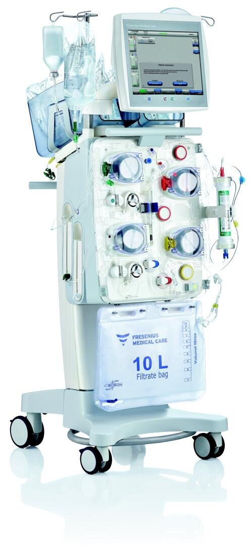 Ein medizinisches Dialysegerät mit Digitalanzeige, Schläuchen, Filtrationskomponenten und einem durchsichtigen Filtratbeutel mit der Aufschrift 10L auf einem fahrbaren Untersatz.