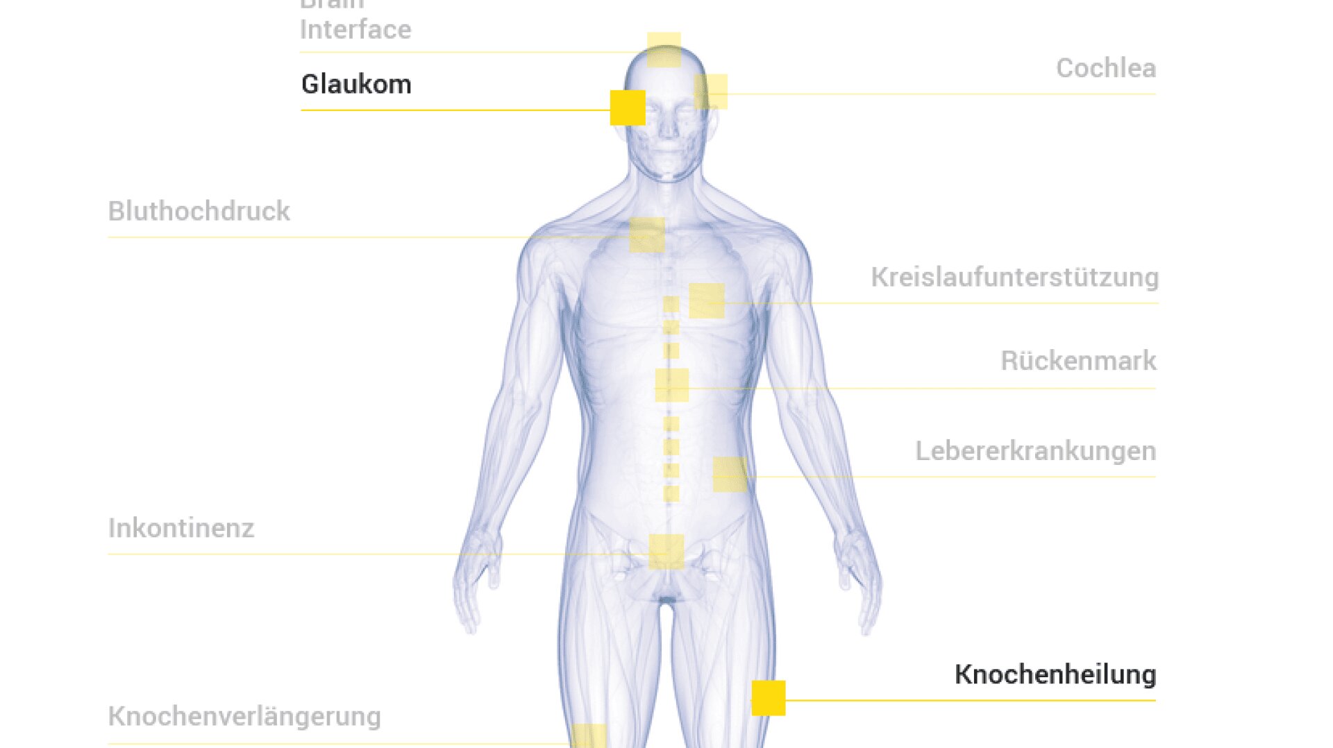 Eine halbtransparente menschliche Figur mit gelb hervorgehobenen Etiketten in deutscher Sprache, die auf Krankheiten hinweisen: Glaukom (am Kopf), Bluthochdruck, Inkontinenz, Knochenverlängerung, Knochenheilung (am Bein), Kreislaufunterstützung, Rückenmark und Lebererkrankungen.