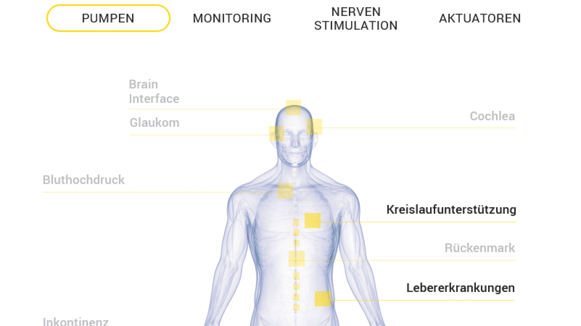 Schema eines menschlichen Körpers mit hervorgehobenen Bereichen und deutschen Beschriftungen, die Anwendungen von medizinischen Pumpen wie Kreislaufunterstützung und Lebererkrankungen zeigen.