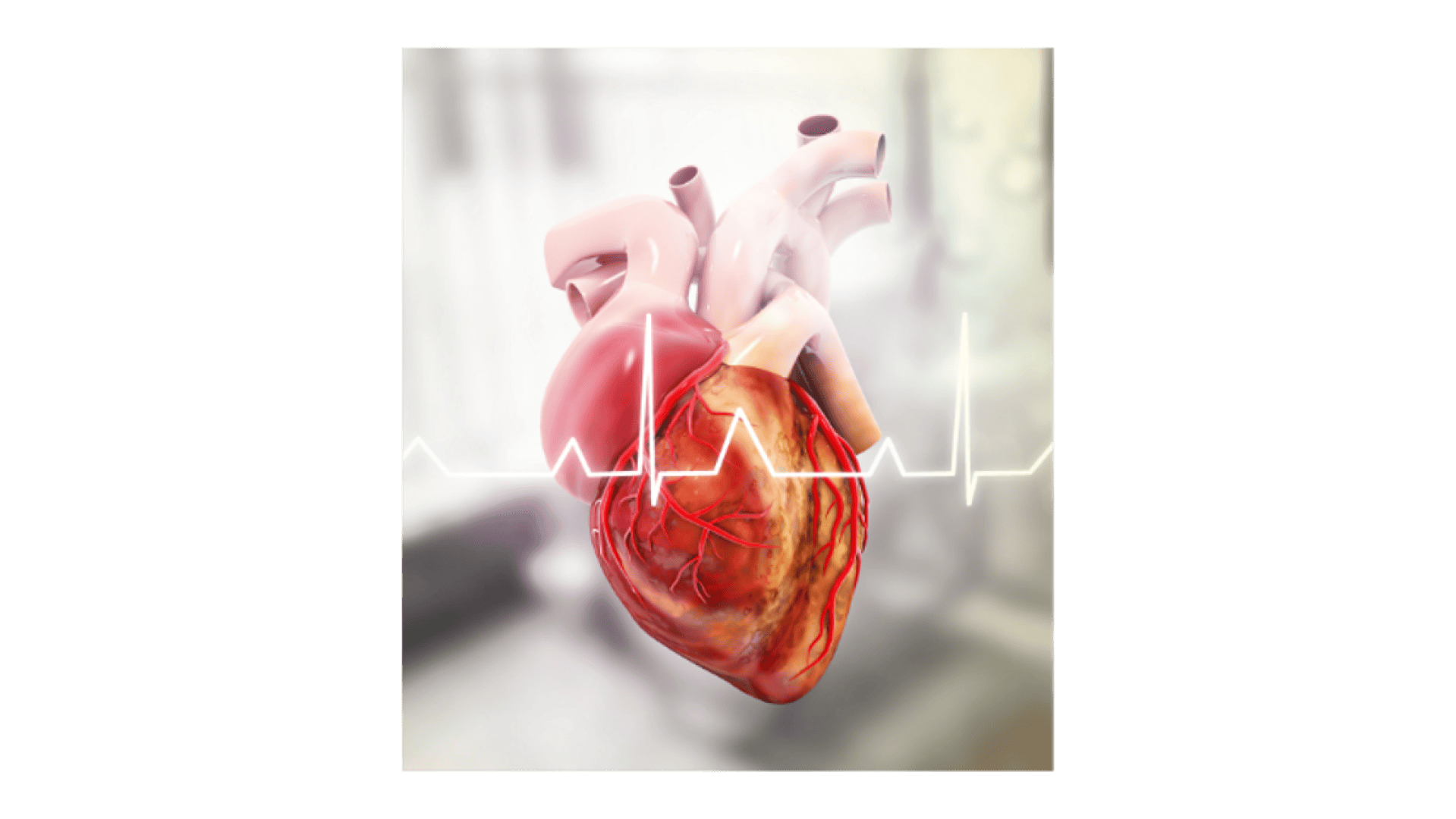 Detaillierte Abbildung eines menschlichen Herzens mit sichtbaren Arterien und Venen, überlagert von einer EKG-Linie (Elektrokardiogramm), vor einem sanft verschwommenen, hellen Hintergrund.